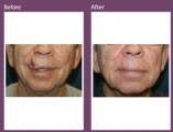 Beyond Aesthetics - Cosmetic Surgery that Repairs
