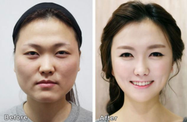 Cultural Differences Defines Attitudes Towards Cosmetic Surgery